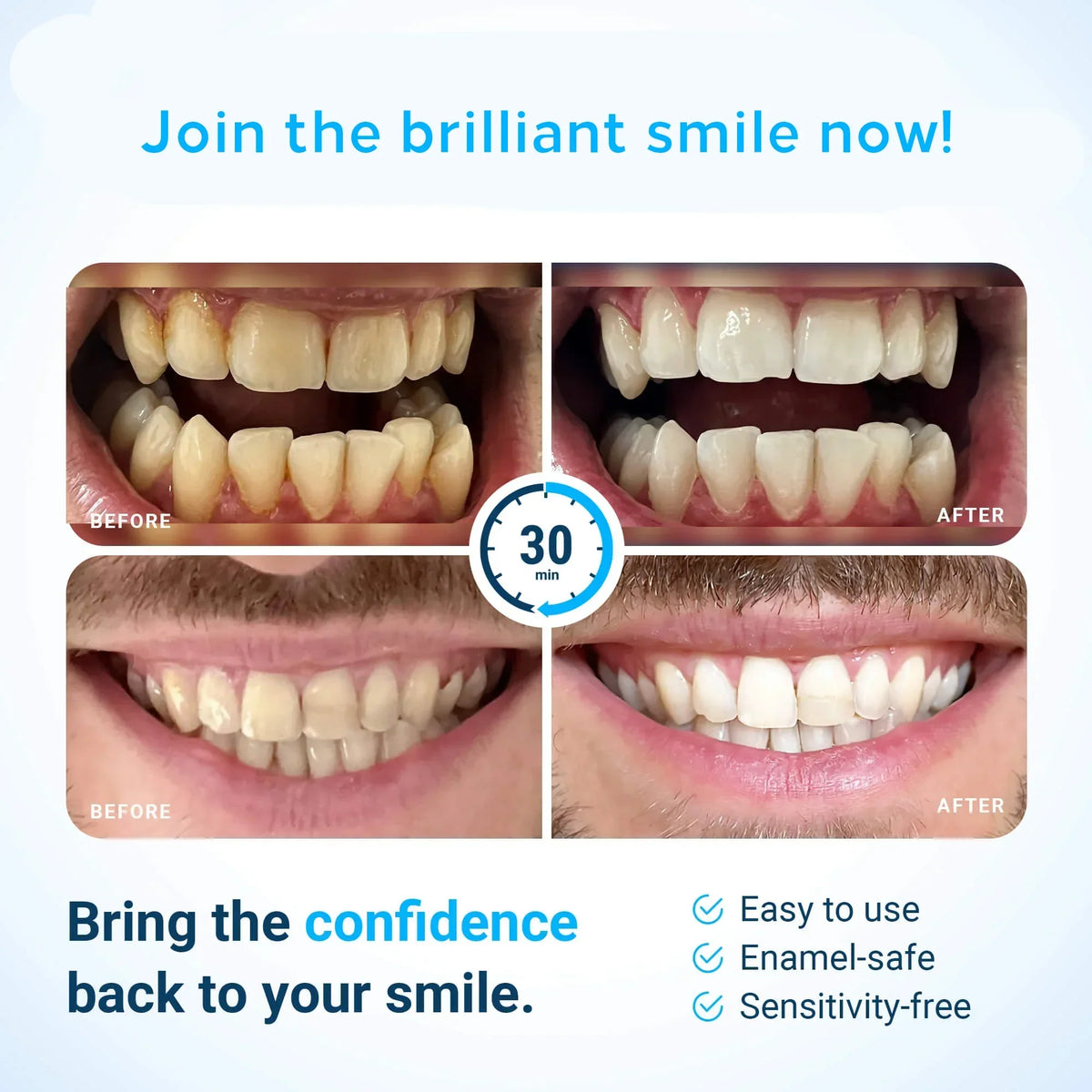 Bright Smile Whitening Strip Kit