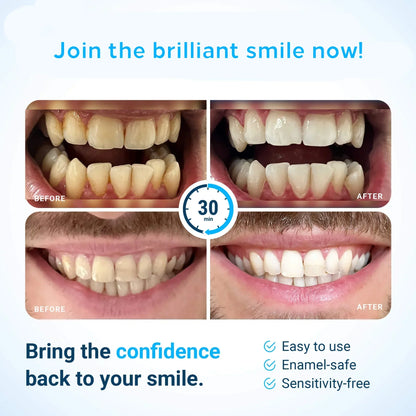 Bright Smile Whitening Strip Kit