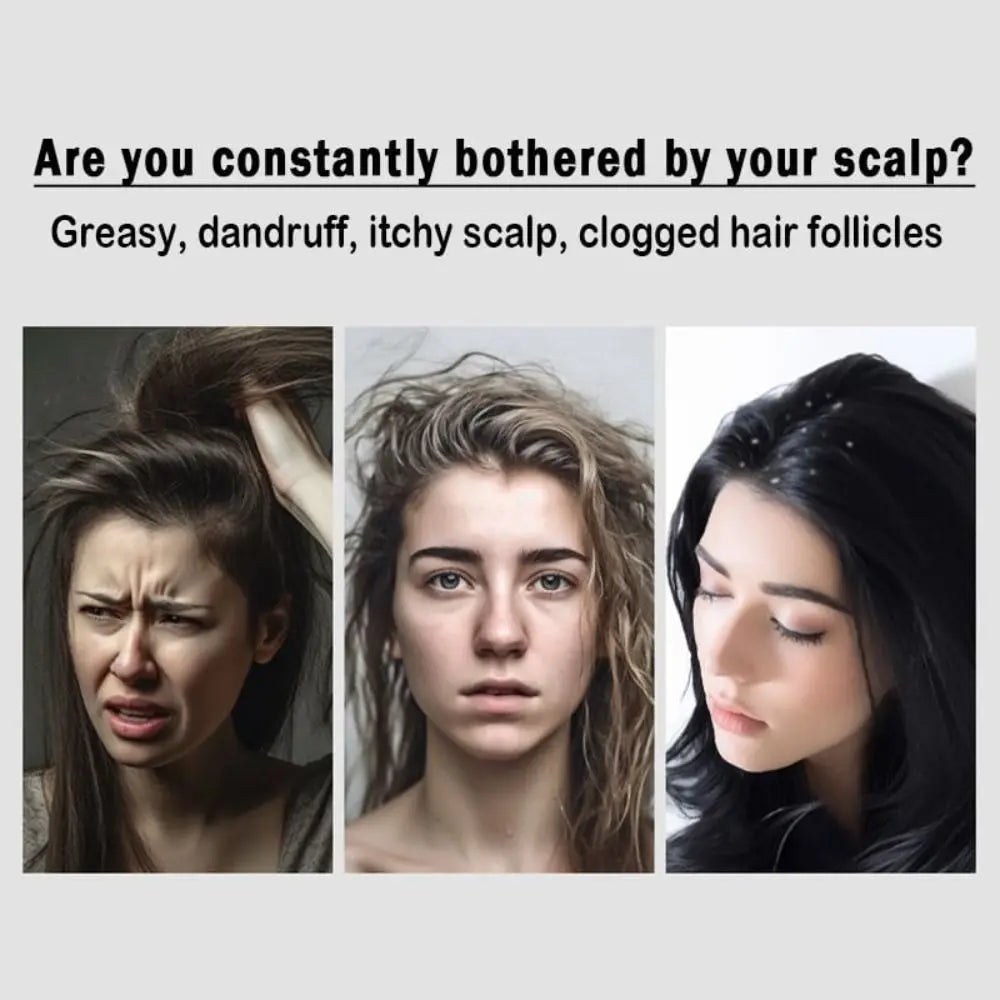 Multi Functional Dandruff Removal Unisex Scalp Comb